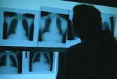Röntgenbilder
