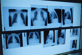 Röntgenbilder