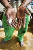 Händer efter glasfiberreparation av bå
