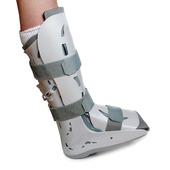 Severe ankle sprain
